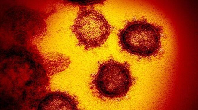 Coronavirus