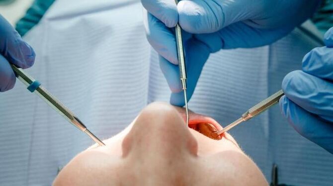 Ein Zahnarzt behandelt einen Patienten