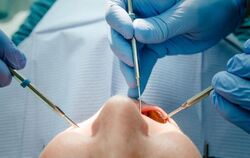 Ein Zahnarzt behandelt einen Patienten