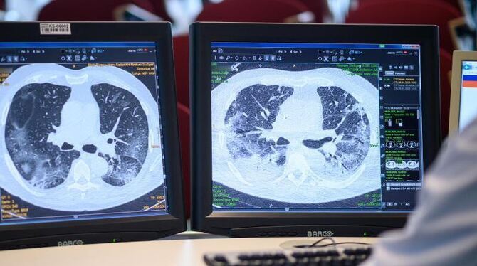 Coronavirus-Behandlung