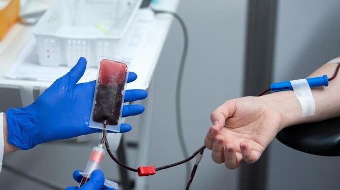 Einer Frau wird bei einer Blutspende eine Blutprobe entnommen