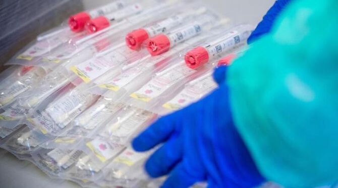 Testsets mit Abstrichstäbchen liegen auf einem Tisch