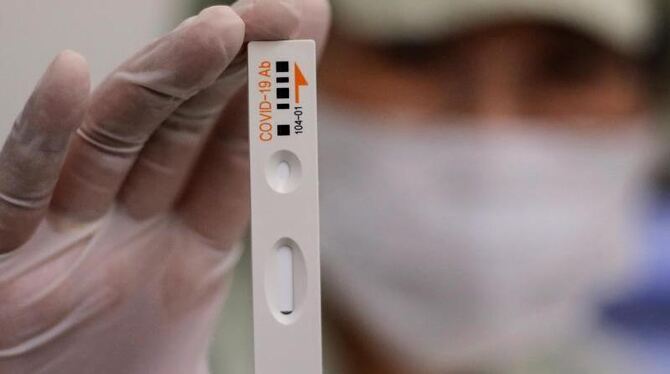 Corona: WHO warnt vor schnellen Immunitätsausweisen