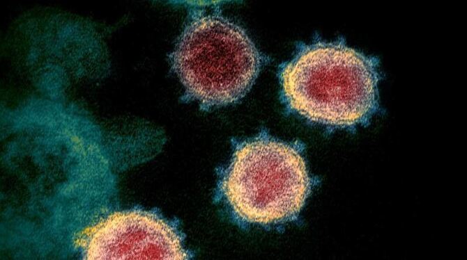 Coronavirus