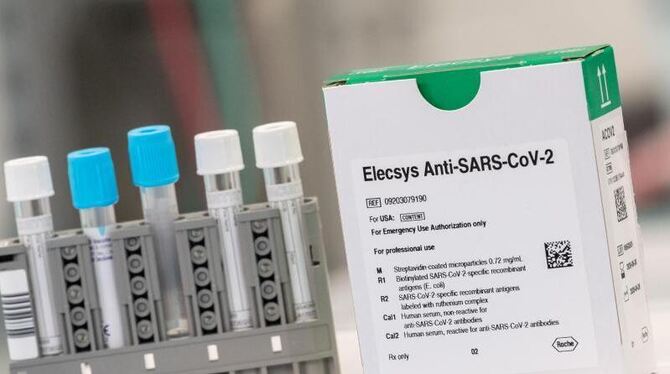 Antikörpertest Elecsys