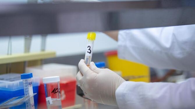 Eine Ärztin zeigt einen Test für das Coronavirus