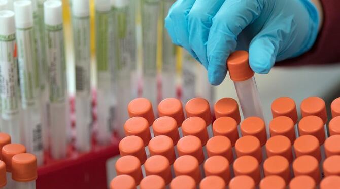 Studie bestätigt Sars-CoV-2-Übertragung vor ersten Symptomen