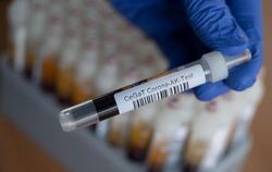 Blutproben für Corona-Antikörper-Tests
