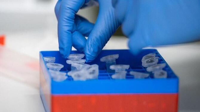 Eine Laborantin führt Untersuchungen zum Coronavirus durch