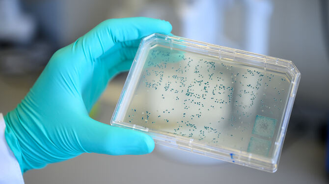 Ein Curevac-Mitarbeiter  zeigt eine Petrischale  mit Bakterienkolonien. FOTO: PICTURE ALLIANCE/DPA