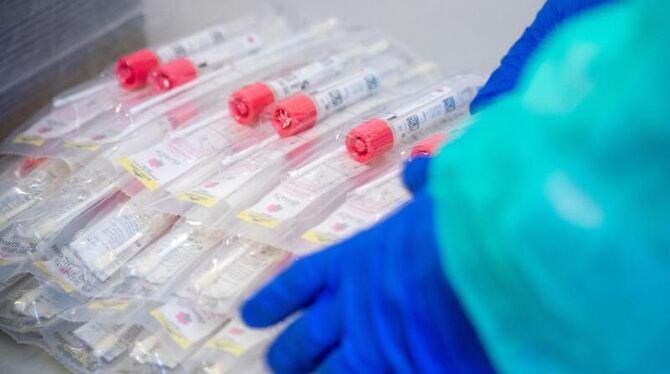 Testsets liegen in einem Testzentrum für Corona-Verdachtsfälle