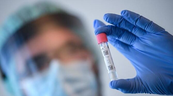 Ein Arzt an einer Corona-Teststelle untersucht einen Abstrich Ein Arzt an einer Corona-Teststelle untersucht einen Abstrich