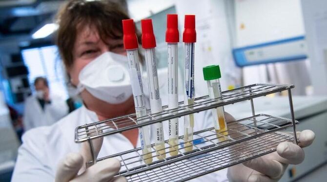 Eine Laborantin führt Untersuchungen zum Coronavirus durch