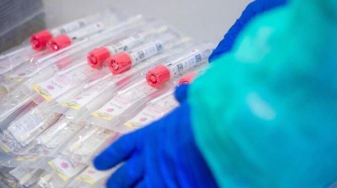 Corona-Tests Corona-Tests