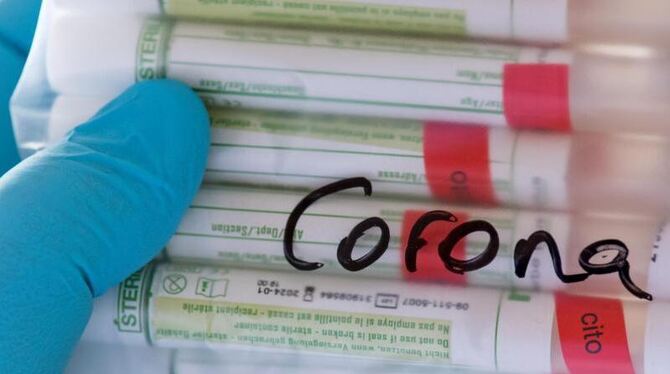 Proben für Corona-Tests werden in einem Labor vorbereitet