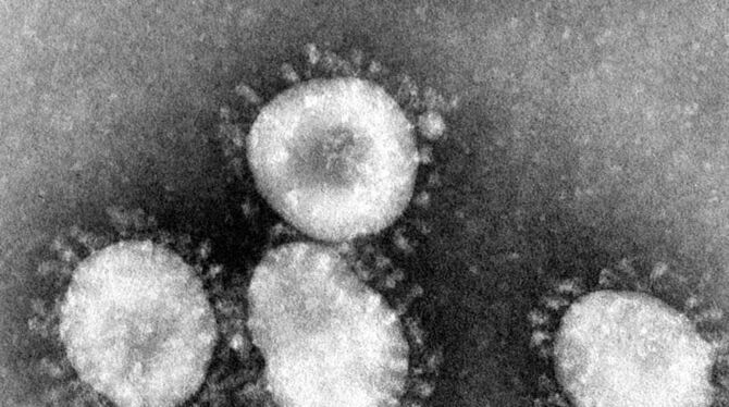 Eine Mikroskopaufnahme zeigt das Coronavirus