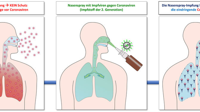 Eine Corona-Impfung in Form eines Nasensprays wird derzeit von einer Forschergruppe an der Tübinger Uniklinik entwickelt. GRAFIK