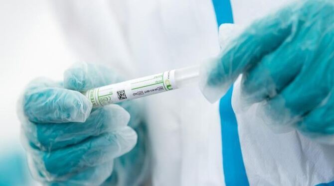 Coronavirus-Test Coronavirus-Test