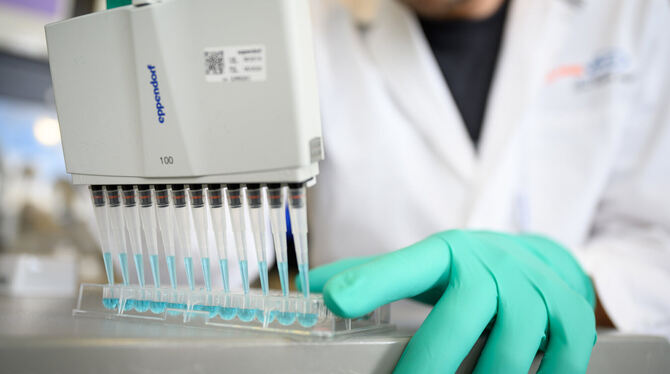 Curevac weitet die Tests seines Impfstoffs aus.  FOTO: GOLLNOW