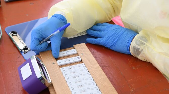 Kostenlose Corona-Schnelltest Reutlingen Eine halbe Stunde braucht es, bis der Schnelltest in Reutlingen ein Ergebnis anzeigt.