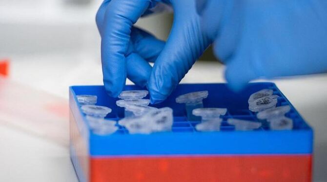 Eine Laborantin führt Untersuchungen zum Coronavirus durch Eine Laborantin führt Untersuchungen zum Coronavirus durch