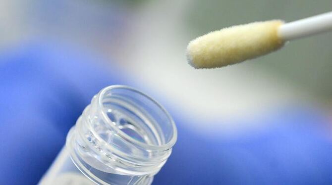 Ein Abstrich für das Testverfahren auf das Coronavirus