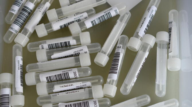 Die Röhrchen mit den Abstrichen für den PCR-Test kommen in ein Balinger Labor.