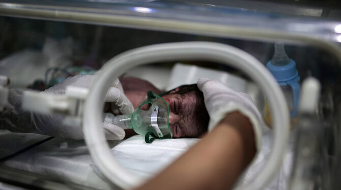 Politiker fordern mehr weltweite Kooperation. Das Foto zeigt ein unterernährtes Neugeborenes im internationalen Krankenhaus UniM