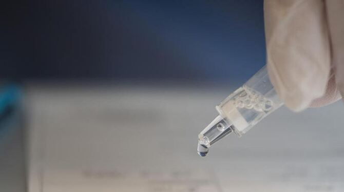 Coronavirus - Schnelltest Coronavirus - Schnelltest