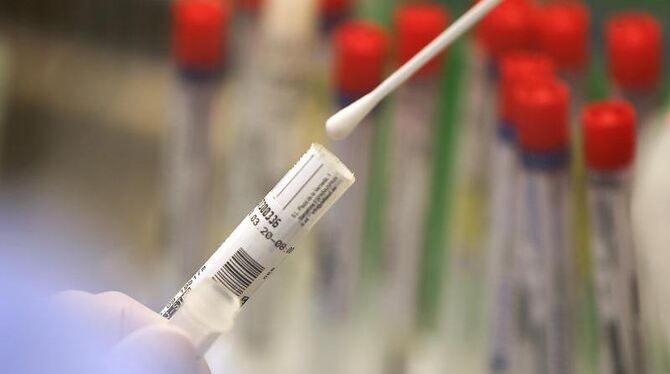 Wattestäbchen mit einem Abstrich für einen Corona-Test