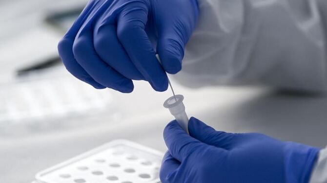 Corona-Schnelltest Corona-Schnelltest