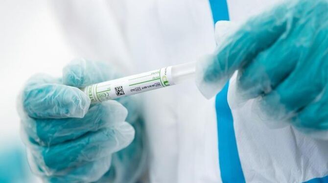 Coronavirus-Test Coronavirus-Test