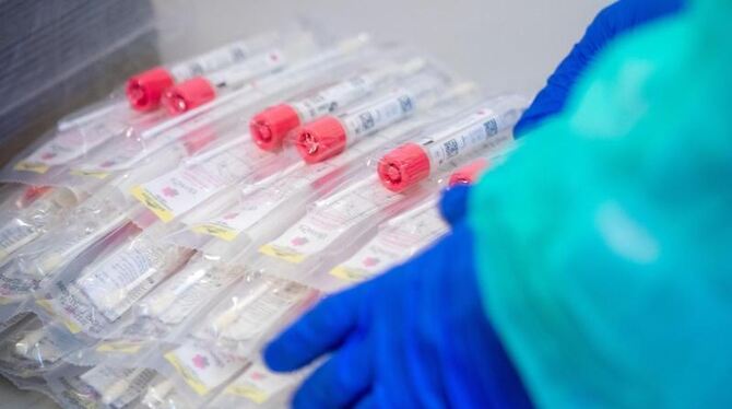 Corona-Tests Corona-Tests