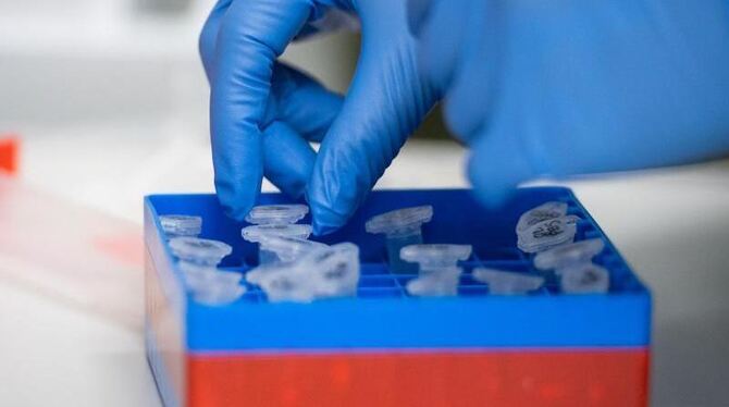 Corona-Tests Corona-Tests