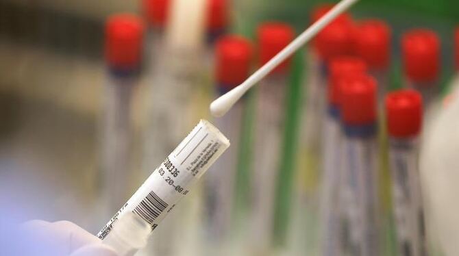 Corona-Test Corona-Test