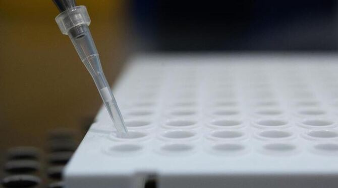 Analyse des Corona-Virus Analyse des Corona-Virus