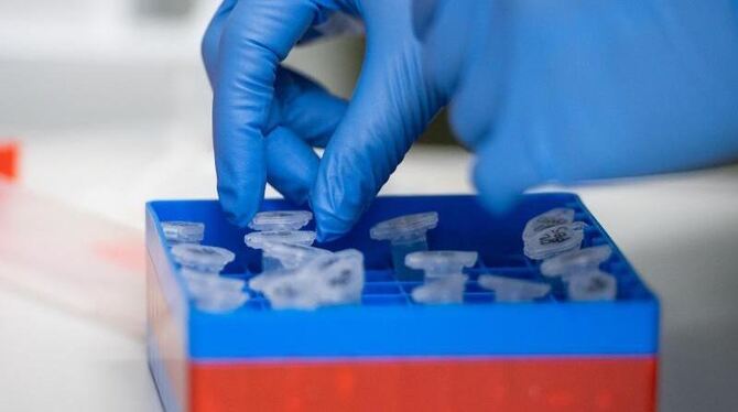 Corona-Tests Corona-Tests