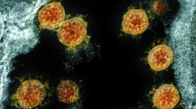 Coronavirus