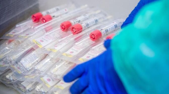 Corona-Tests Corona-Tests