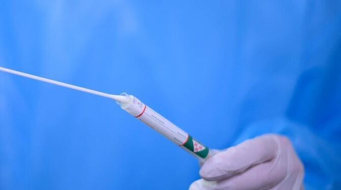 Corona-Test Corona-Test