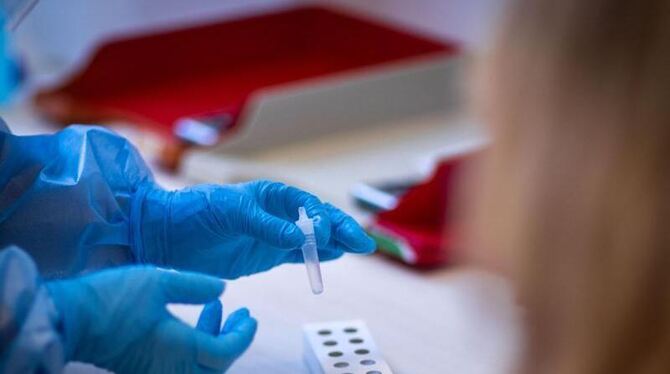 Corona-Test Corona-Test