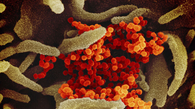 Eine undatierte elektronenmikroskopische Aufnahme des »U.S. National Institute of Health« zeigt das neuartige Coronavirus (SARS-