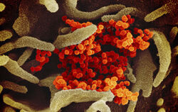 Eine undatierte elektronenmikroskopische Aufnahme des «U.S. National Institute of Health» zeigt das neuartige Coronavirus (SARS-
