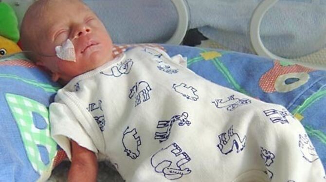 Seit Gründung des Frühchen-Vereins gab es viele riesengroße Hilfen für winzig kleine Reutlinger. FOTO: ARCHIV Seit Gründung des Frühchen-Vereins gab es viele riesengroße Hilfen für winzig kleine Reutlinger. FOTO: ARCHIV