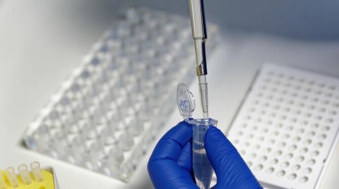 Coronavirus - PCR-Test