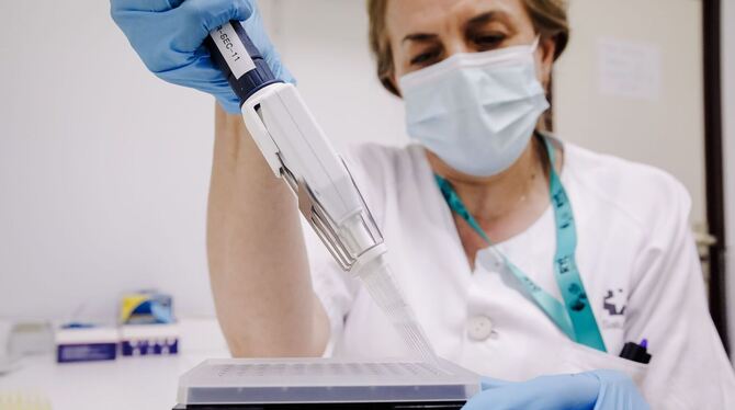 Affenpocken - Tests Affenpocken - Tests