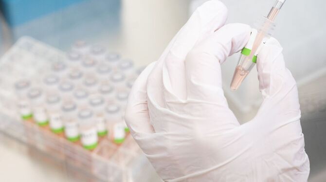 Eine biologisch-technische Assistentin bereitet PCR-Tests vor