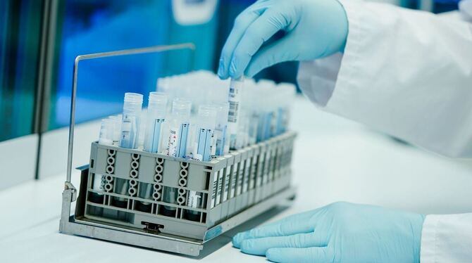 PCR-Tests