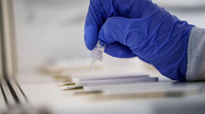 Corona-Test Corona-Test