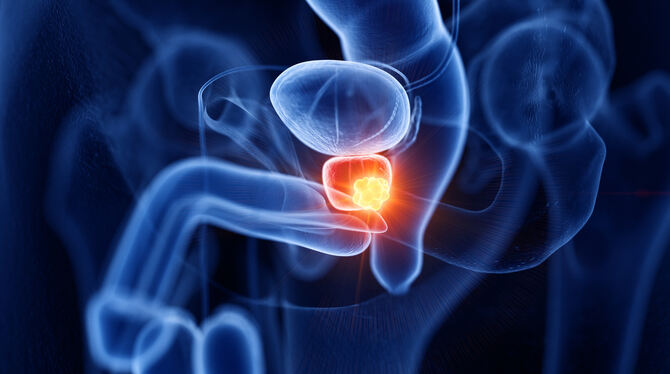 Ab 40 Jahren nimmt das Risiko zu, an der Prostata zu erkranken.  FOTO: SCIEPRO/ADOBE STOCJ
